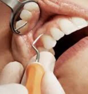 dental implant image