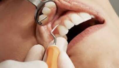 dental implant image