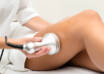 Laser Treatment for Hair Removal