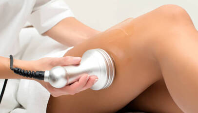 Laser Treatment for Hair Removal