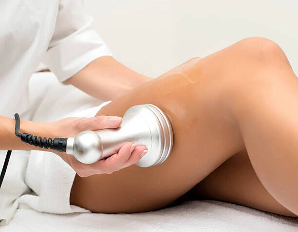 Laser Treatment for Hair Removal