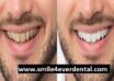 Professional Natural Looking Teeth Houston Dental Care
