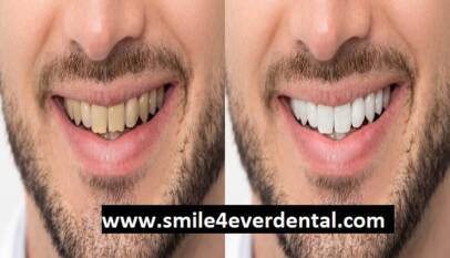 Professional Natural Looking Teeth Houston Dental Care
